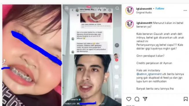 Anak Balita Gunakan Behel, Netizen : Ibunya Gimana Sih!