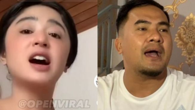 Dewi Perssik Sebut Saipul Jamil Lakukan Pelecehan Seksual di Dalam Penjara: Orangnya sampai Infeksi...