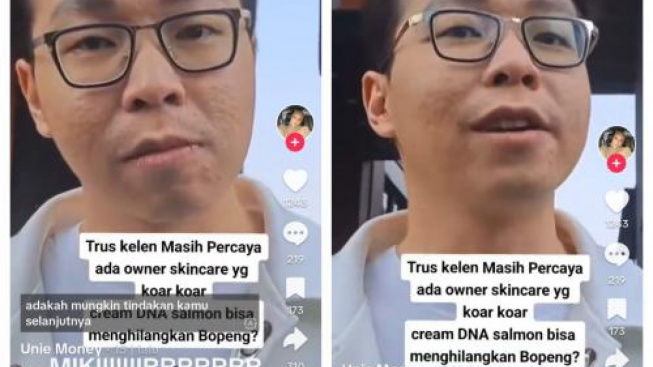 dr.Richard Kena Hujat Warganet, Wajah Aslinya Terungkap: Tak Seglowing di Kamera