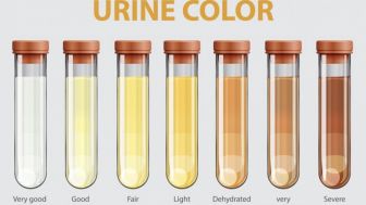 Kenali Beberapa Penyakit Berbahaya Lewat Warna Urine, Berikut Penjelasanya