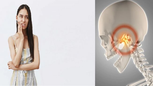 Sendi Rahang Sering Bunyi 'Klek'?, Ini Penyebabnya Kata Dokter