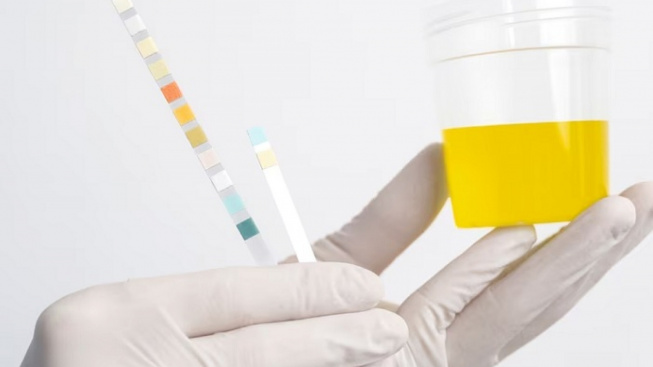 Wujudkan Kampung Bebas Narkoba, Desa Sukatani Wajibkan Catin Tes Urine