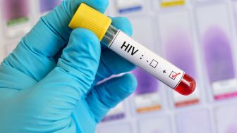 Poligami Solusi HIV/AIDS? Ini Pandangan Ulama Tentang Poligami dan HIV/AIDS