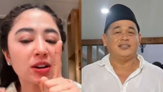 Usai Digeruduk Warga, Dewi Perssik Akui Malu dan Ingin Akhiri Perseteruan dengan Ketua RT: Gak Usah Dibesar-besarkan