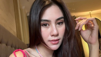 Blak-blakan! Billy Syahputra Sebut Wajah Syahnaz Jelek di Masa Lalu: Sekarang Mah Cantik Kebantu Perawatan