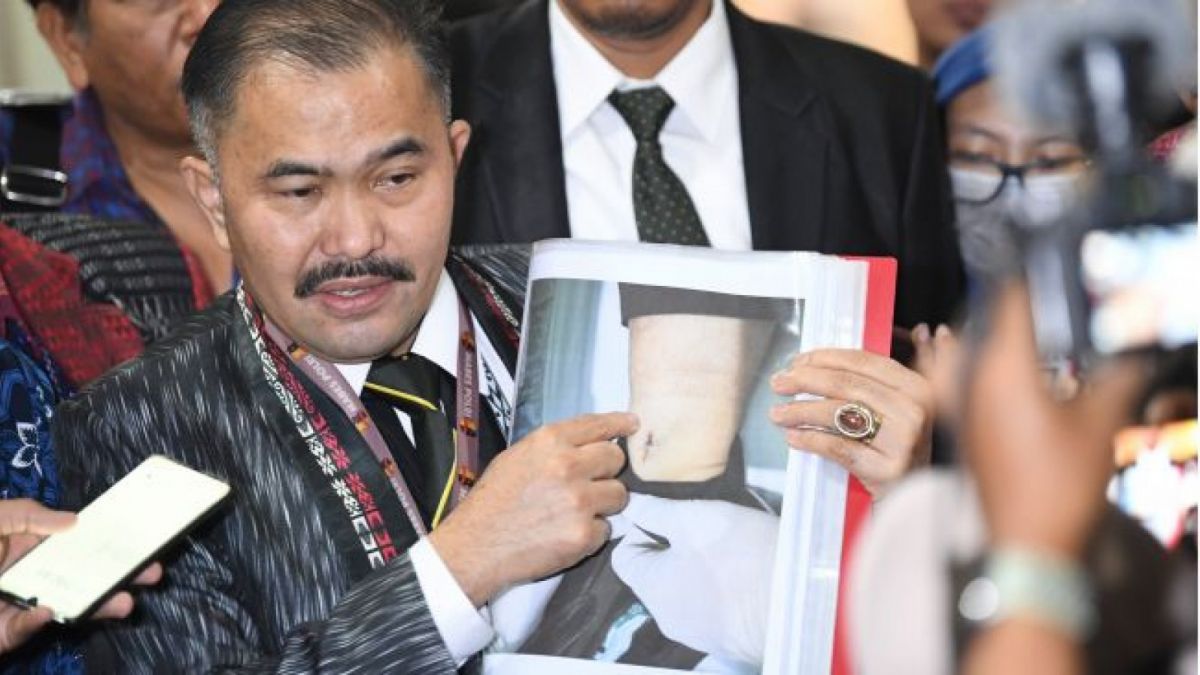 Kamaruddin Simanjuntak (tengah) ketika menunjukkan bukti foto korban usai pelaporan di Bareskrim Mabes Polri, Jakarta, Senin (18/7/2022) [ANTARA FOTO/M Risyal Hidayat/hp]