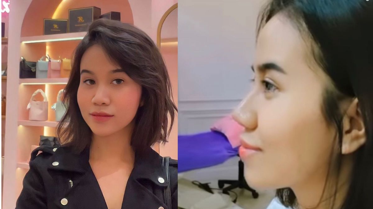 Potret Mayang sebelum dan sesudah lakukan operasi plastik. [Instagram/@mayaang.lucyaana]