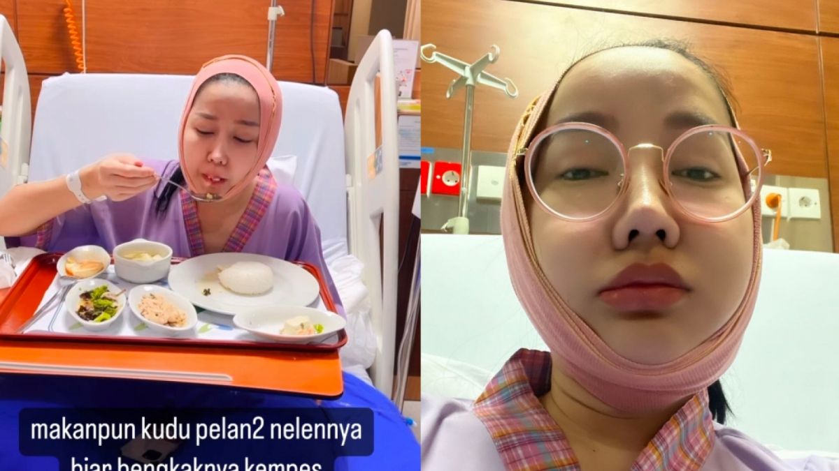 Kondisi Terkini Lucinta Luna Akibat Gusi Membengkak: Wajah Dibungkus Perban, Setiap Fisioterapi Selalu Keluar Cairan... [Instagram/@lucintaluna_manjalita]