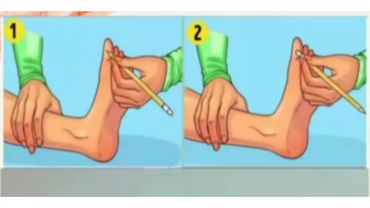 Tes Kesehatan Sederhana Diabetes. [(Tiktok/Tips Kesehatan)]