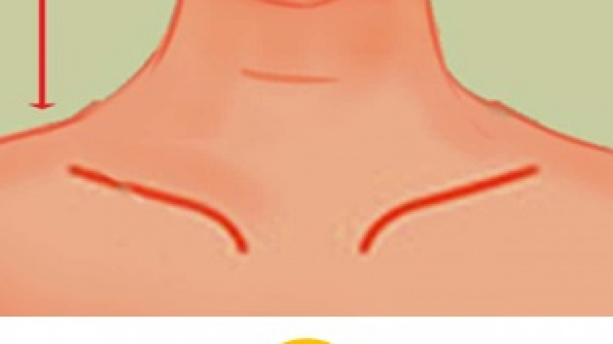 Ciri Kepribadian Leher Pendek [Jaran Josh]