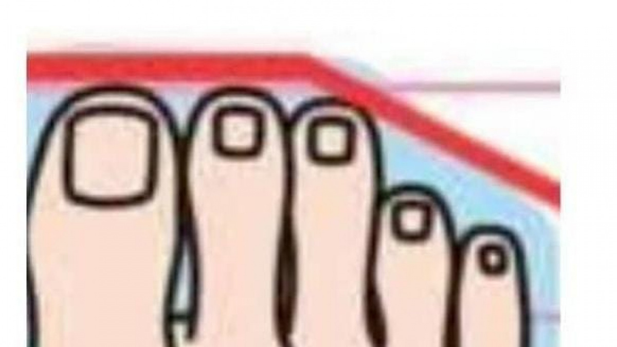 Bentuk jari kaki. [instagram @teskepribadian.id]