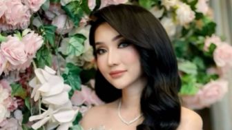 Pamer Wajah Barunya Usai Operasi Plastik, Netizen Sebut Lucinta Luna Cantik Dulu