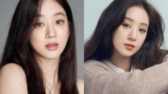 Karier Jung Ryeo Won 'Cinta Pertama Hyun Bin' Terpuruk Gara-gara Operasi Plastik