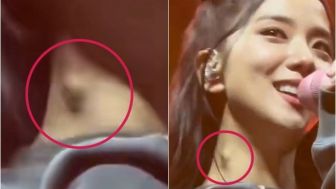 Benjolan di Leher Jisoo BLACKPINK Bikin Penggemar Khawatir, Ada Tumor?