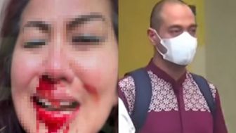 Sadis! Venna Melinda Dibekap, Ditindih, dan Wajahnya Ditekan Kepala Ferry Irawan: Tolong-tolong Hidung Saya Patah