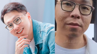 Punya Usaha Skincare, Wajah Asli dr Richard Lee Ketahuan saat Tak Pakai Filter, Netizen: Wajahnya Bruduk Juga