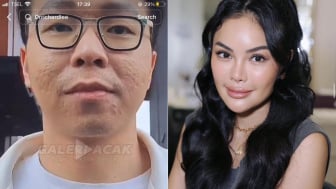 Persaingan Jualan Skincare Makin Panas, Nikita Mirzani Jatuhkan Citra dr Richard Lee: Bisnis Skincare Tapi Muka Lo Bopeng