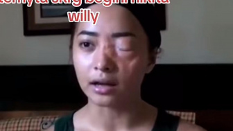 Wajah Nikita Willy Setengah Lumpuh Viral di TikTok, Netizen Langsung Report