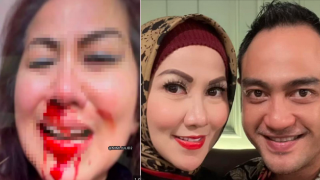 Venna Melinda: Saya Sampai Dikunci, Saya Bilang Tolong-tolong Lepaskan