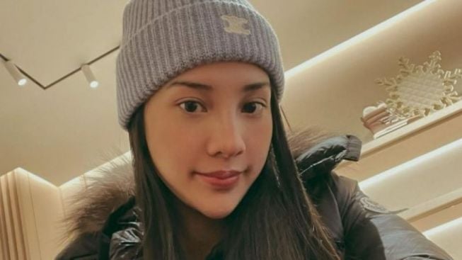 Heboh! Muka Anya Geraldine Bonyok, Tapi Bukan Dipukul Orang