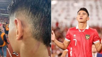 Kena Cakar Gelandang Lawan, Marselino Ferdinan Tunjukkan Luka Merah di Kepala?