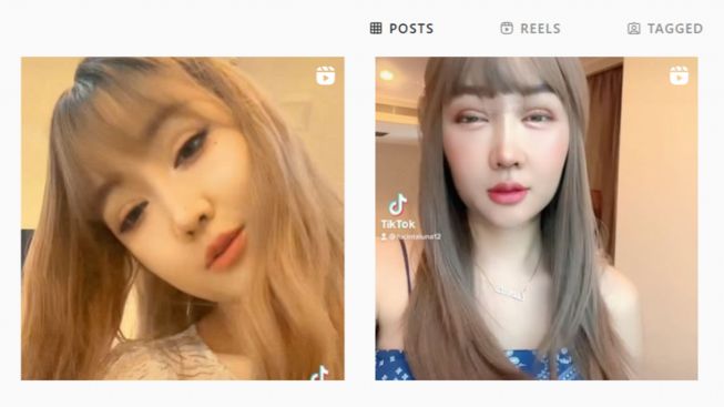 Pamer Foto Wajah Bengkak, Lucinta Luna: Kalo Sudah Kempes Mirip Jisoo BLACKPINK