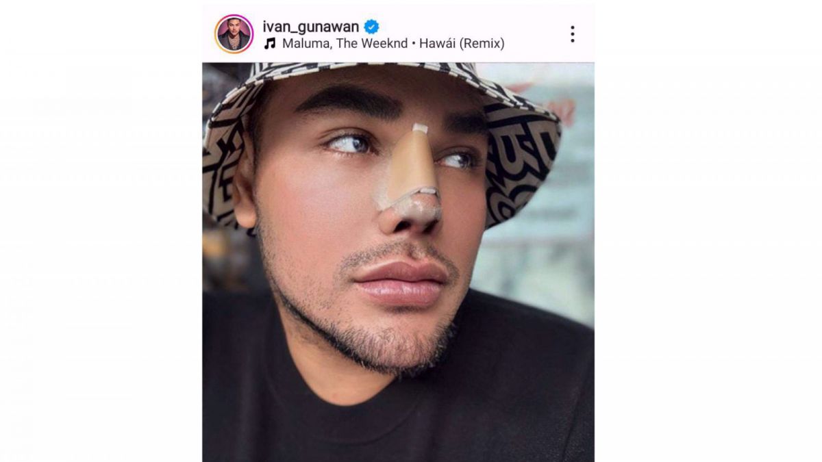 Ivan Gunawan Dengan Hidung DIbalut Perban [Instagram/@ivan_gunawan]