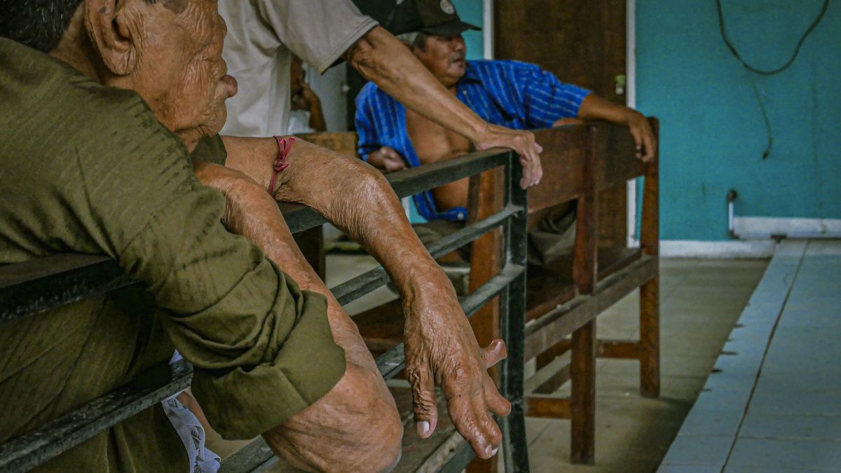 Leprosy survivors in Leprosy Village, Neglasari, Tangerang City, Banten, Sunday (29/1/2023). [SuaraSerang/Wawan Kurniawan]