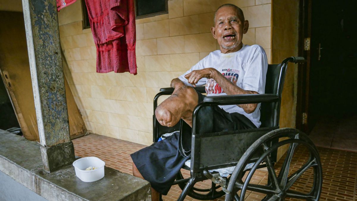 A leprosy survivor during his afternoon activities at his house in Leprosy Village, Neglasari, Tangerang City, Banten, Sunday (29/1/2023). [SuaraSerang/Wawan Kurniawan]