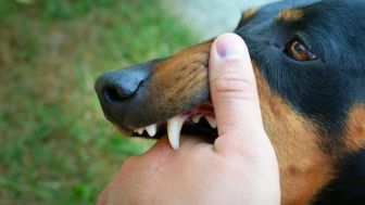 Bali Belum Tetapkan KLB meski Kasus Rabies Tinggi