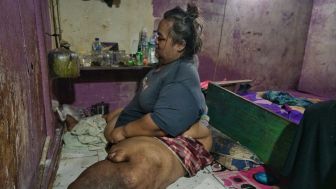 Kisah Sedih Cipto Raharjo Pria Obesitas 200 Kg di Tangerang, Hidup Sulit Ekonomi Menghujam