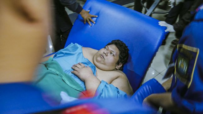 Dirawat Intensif di RSCM, Fajri Pasien Obesitas 300 Kg asal Tangerang Ditangani Tim Dokter Spesialis