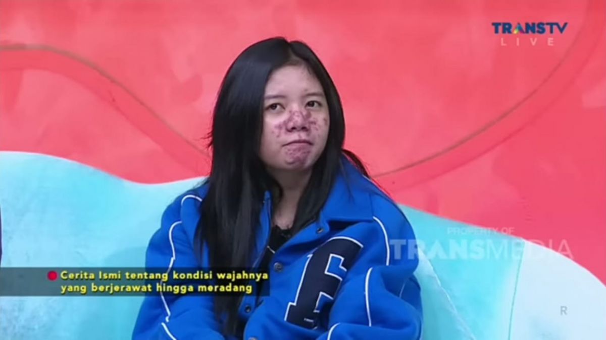 Seleb Tiktok Ismi Nurhidaya Diduga mengindap penyakit Ain [Tangkapan Layar Youtube @Trans TV Official]