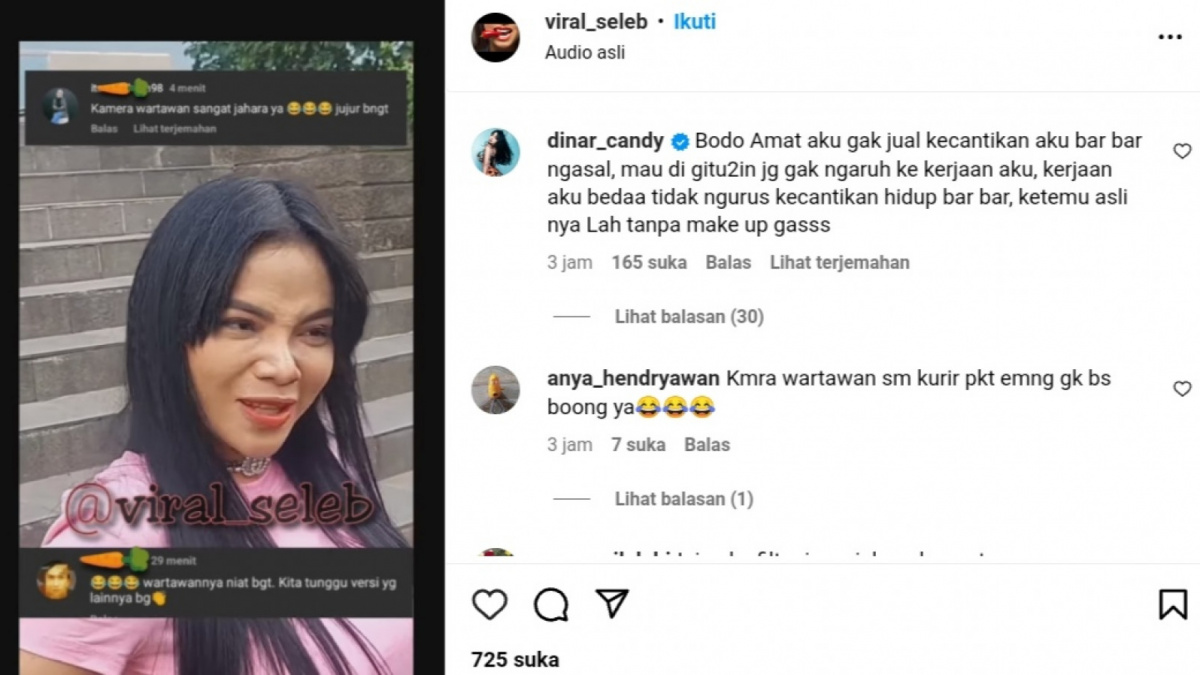 Dinar Candy tanggapi soal wajahnya [Instagram/ @viral_seleb]