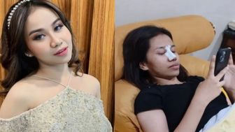 Adik Vanessa Angel Oplas Hidung, Mayang : Penampilan Nomor Satu