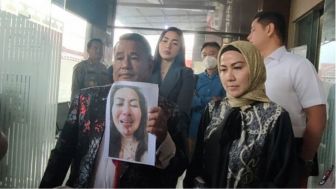 Venna Melinda Alami KDRT usai di Paksa Melayani Saat Sakit dan Bekerja, Saya Udah Capek!