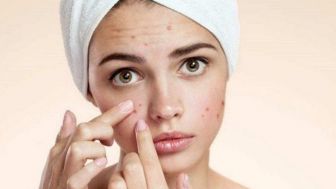 Tips Wajah Sehat, Mencuci Muka yang Benar Terhindar dari Jerawat