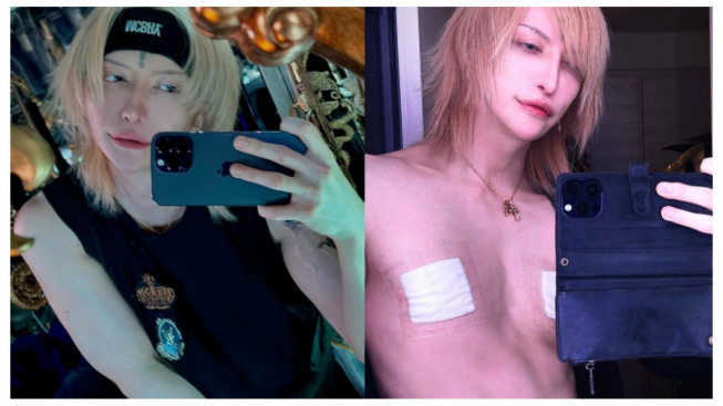 Diluar Nalar, MiA Gitaris Band Rock Mejibray Asal Jepang Nekat Operasi Puting