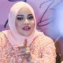 Fans Kecewa Aurel Hermansyah Sulam Alis: Diizinin Sama Atta?