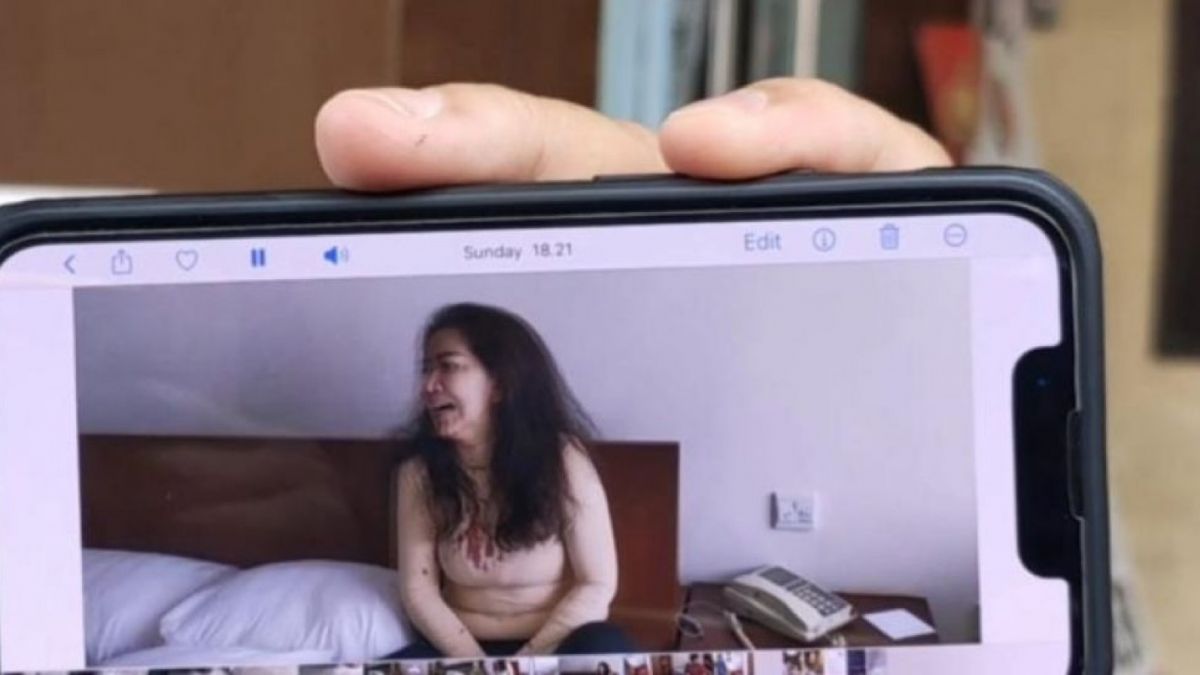 Venna Melinda usai alami KDRT [Foto: Istimewa]