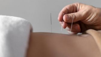 Akupuntur Dapat Kurangi Efek Samping Pasien Kanker