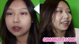 Netizen Salfok ke Tanda Merah di Leher Sisca Kohl saat Umumkan Kehamilan: Terlalu Ganas