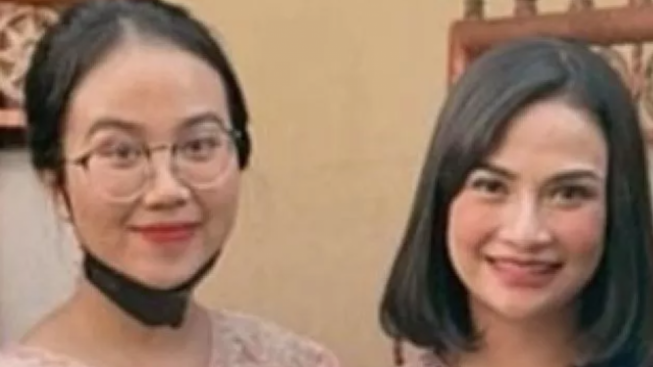 Mayang Pamer Hidung Mancung Hasil Oplas, Terobsesi Mirip Vanessa Angel?