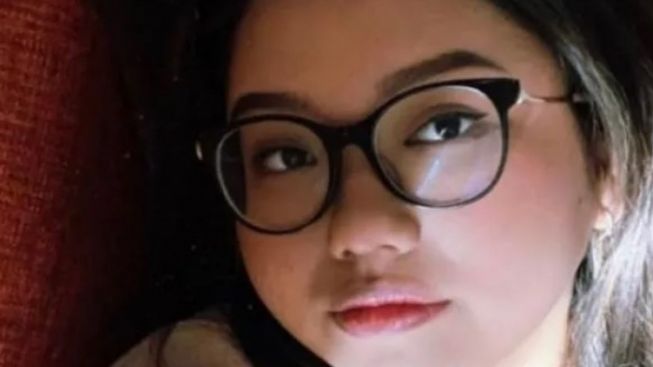 CEK FAKTA: Azab Mengerikan, Putri Sulung Ferdy Sambo Terjangkit Penyakit Langka