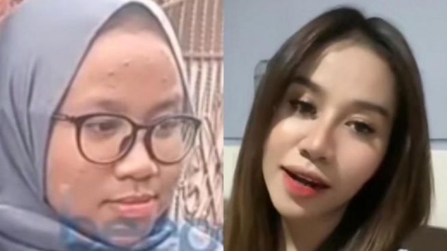 Wajah Mayang Sebelum Dan Sesudah Operasi Plastik Viral, Disentil Muslimah Lepas Hijab