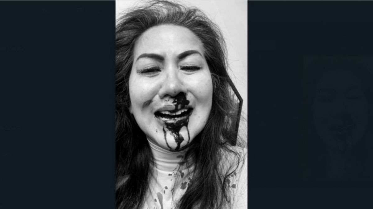 Venna Melinda alami KDRT