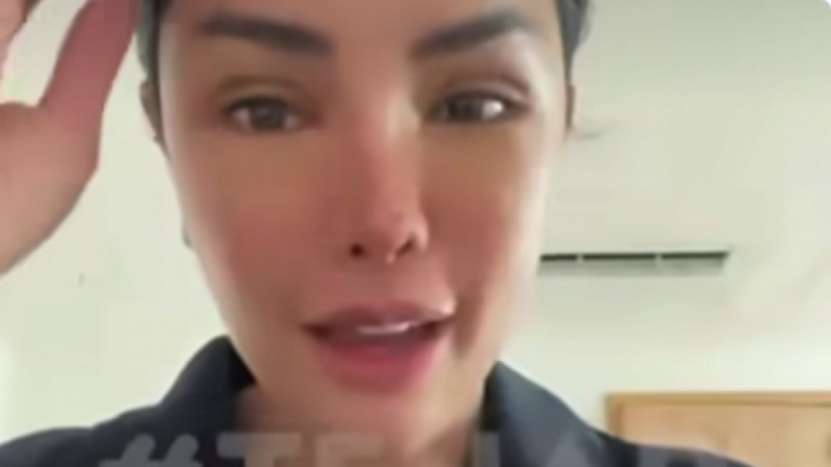 Wajah Nikita Mirzani Usai Operasi Plastik [Tangkap Layar Instagram]