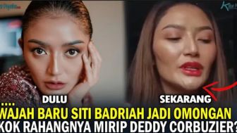 HEBOH, Penampilan Wajah Baru Siti Badriah Jadi Gunjingan, Netizen: Kok Rahangnya Mirip Deddy Corbuzier