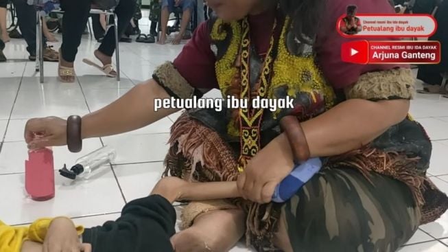 Soal Bahaya Tidaknya Pengobatan Ibu Ida Dayak, Spesialis Ortopedi Beberkan: Ada.....