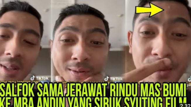 Jerawat Rindu Arya Saloka Bikin Salfok, Pertanda Kangen Berat pada Amanda Manopo?